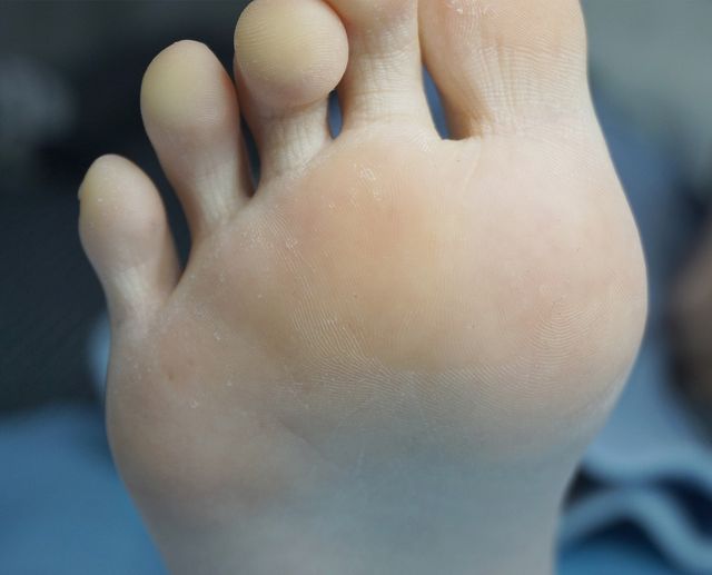 10세 여성 · 9개월 경과