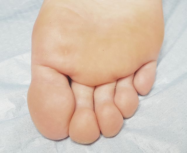 29세 여성 · 3개월 경과